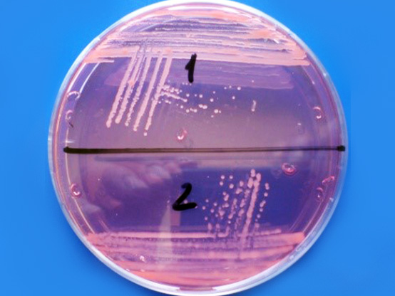 Bactérias isoladas dos nódulos radiculares de leguminosas e crescidas em placas contendo meio de cultura específico Bactérias isoladas dos nódulos radiculares de leguminosas e crescidas em placas contendo meio de cultura específico